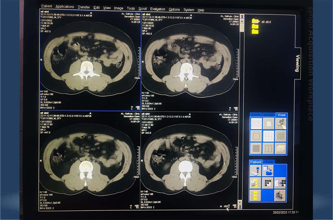 CT-scan-siemens-somatom-sensation-40-slic