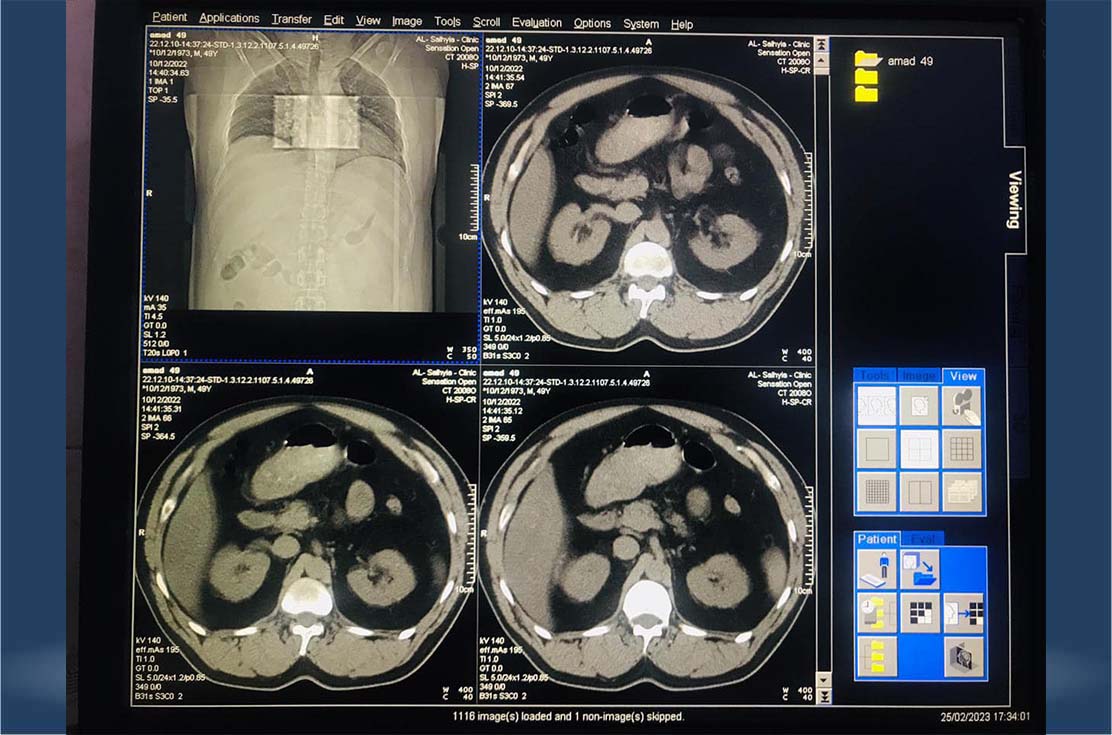 CT-scan-siemens-somatom-sensation-40-slic